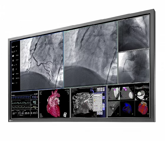 EIZO 58 8MP Color LCD surgical monitor