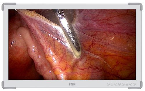 FSN 27 4K Medical Monitor